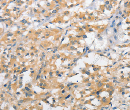 ATG10 Polyclonal Antibody - 2