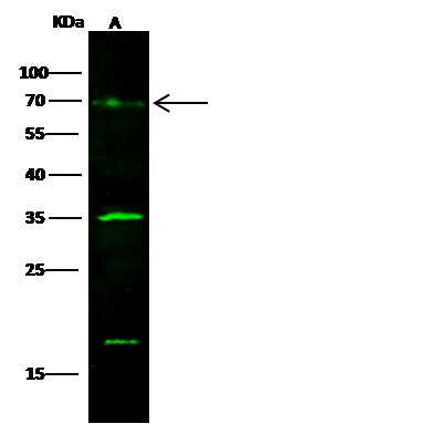 GOLM1/GP73 Monoclonal Antibody-searchlist-1