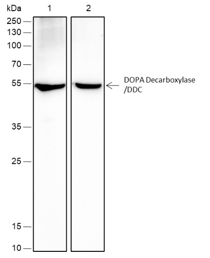 Recombinant DOPA Decarboxylase/DDC Monoclonal Antibody-searchlist-1