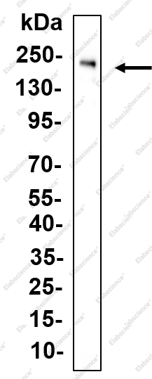 Recombinant Brm Monoclonal Antibody - 1
