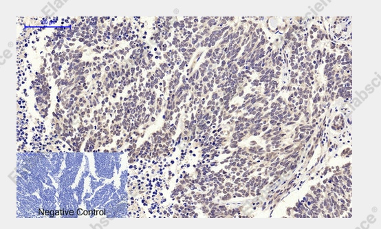 c-Myc Polyclonal Antibody - 3