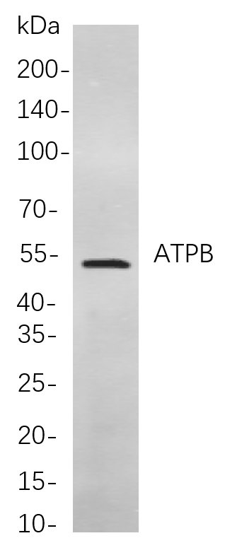 Recombinant ATPB Monoclonal Antibody-searchlist-1