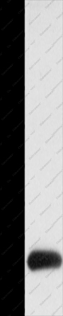 Claudin 4 Polyclonal Antibody - 1
