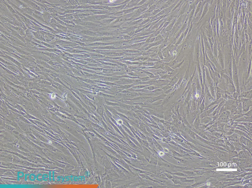 Human Esophageal Fibroblast Complete Medium - 2