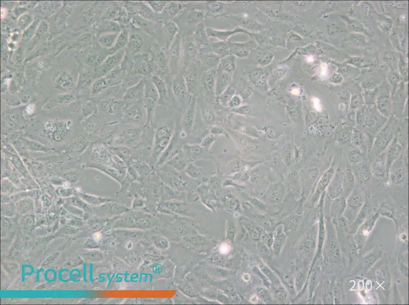 PUMC-HUVEC-T1 Cell Complete Medium - small - 5