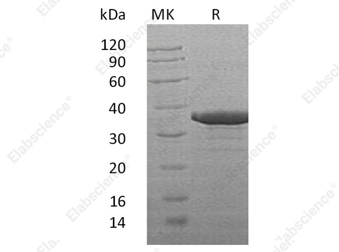Recombinant Human SULT2B1 Protein (His Tag) - 1