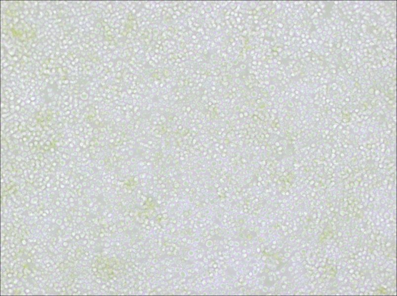 OKT 11 Cell Complete MediumOKT 11 Cell Complete Medium - 2