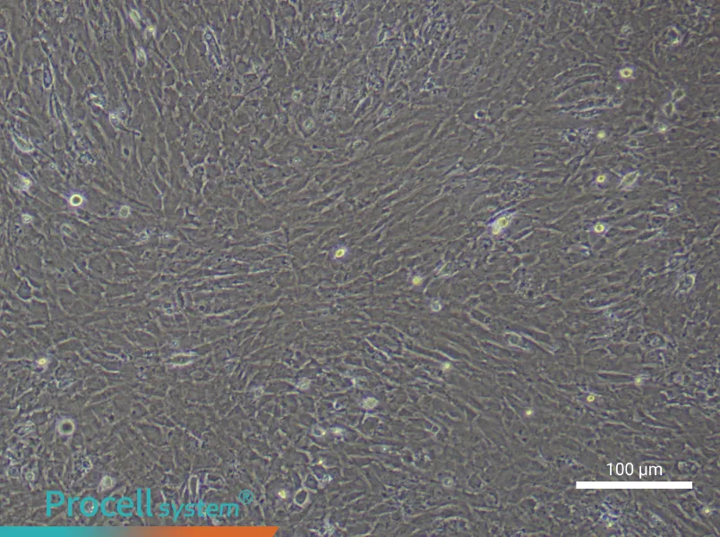Rat Scleral Fibroblast Complete Medium - 1
