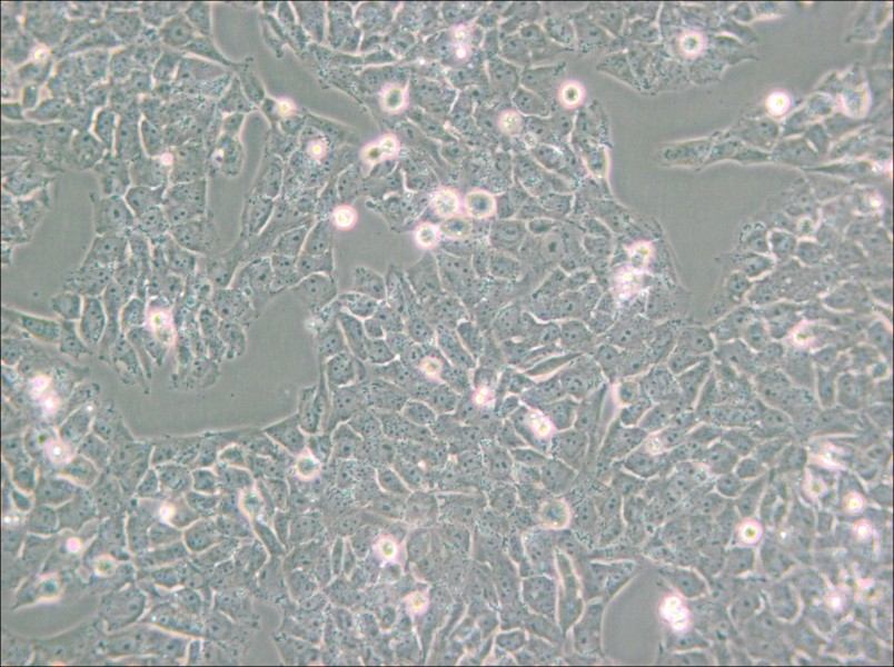 SK-N-AS Cell Complete Medium - small - 6