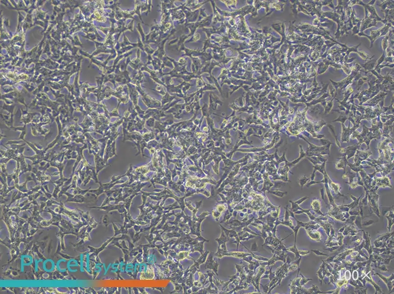 SK-N-BE(2) Cell Complete Medium - 3