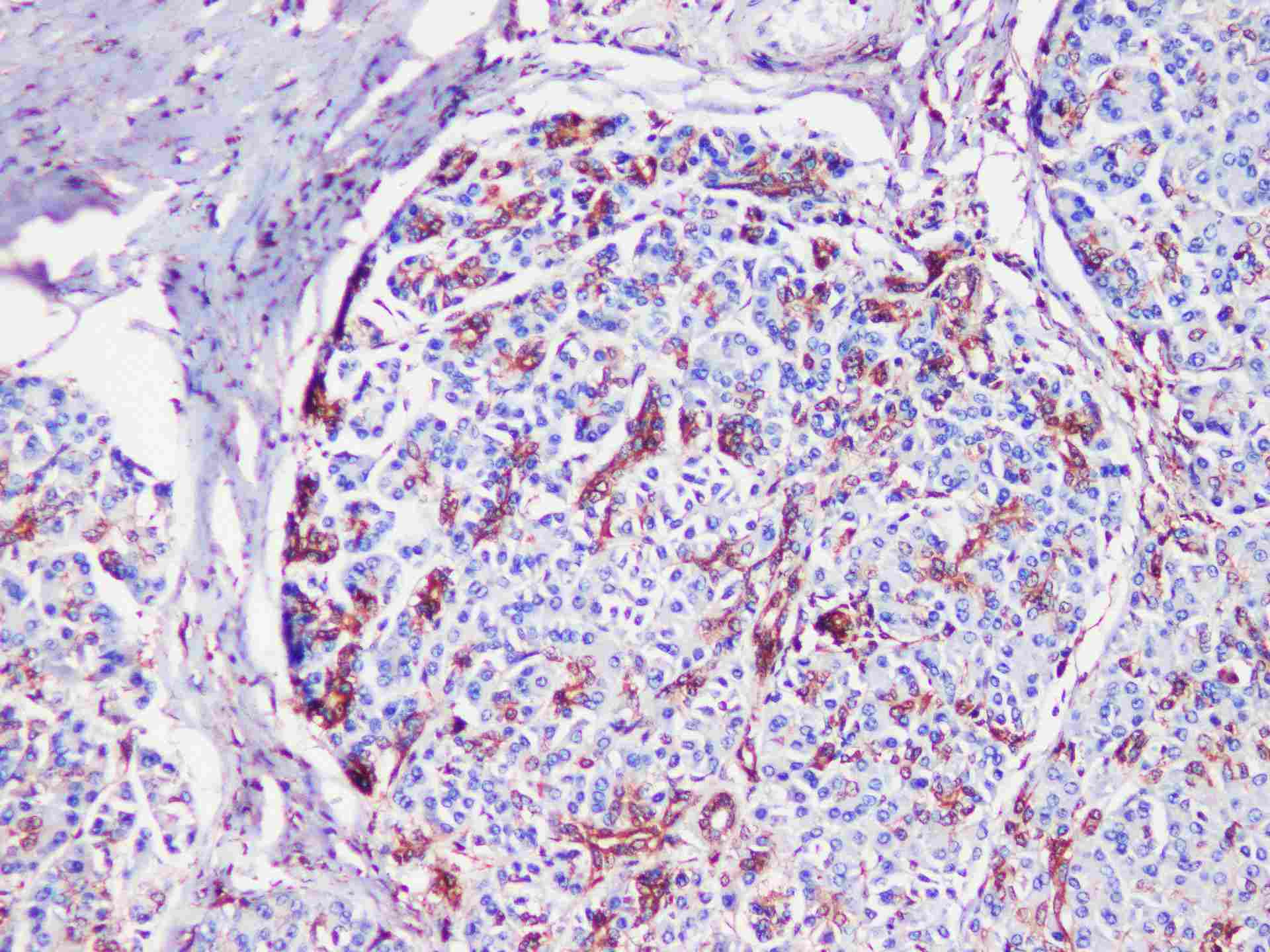 S100A11 Polyclonal Antibody - 3