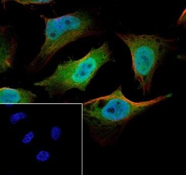 Recombinant Pin1 Monoclonal Antibody - 3