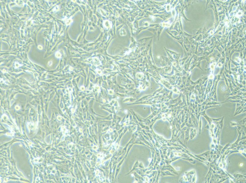 NCI-H1975 Cell Complete Medium - 2