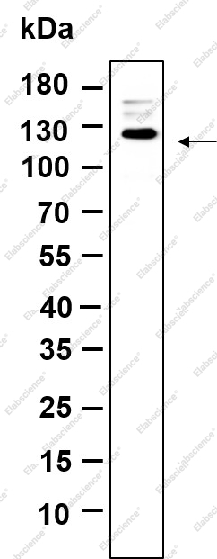 Recombinant Rb Monoclonal Antibody - 1