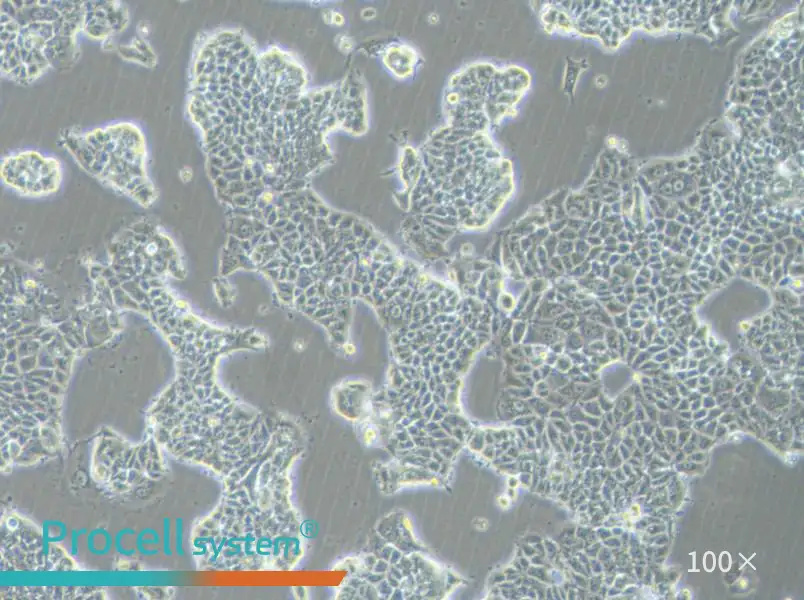 MCF-7-FLUC Cell Complete Medium - 1