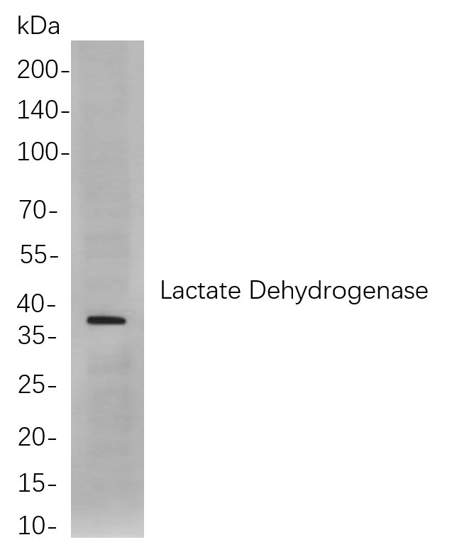 Recombinant Lactate Dehydrogenase Monoclonal Antibody-searchlist-1