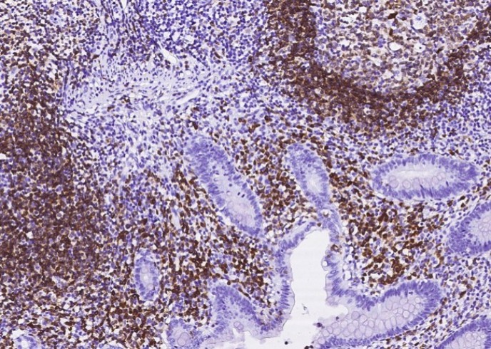 Recombinant CD79A/Ig-alpha Monoclonal Antibody - small - 3