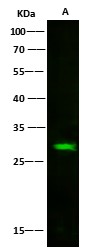 Recombinant Latexin/LXN Monoclonal Antibody - small - 4