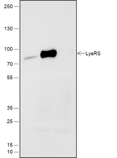 Recombinant LysRS Monoclonal Antibody - small - 6