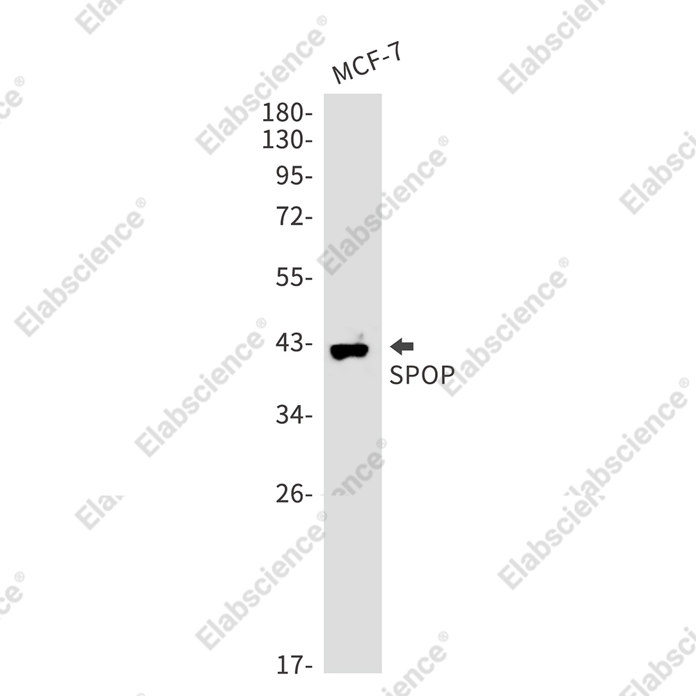 Recombinant SPOP Monoclonal Antibody - 1