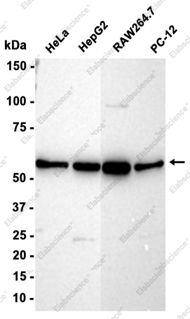 Recombinant PRPF31 Monoclonal Antibody - 2