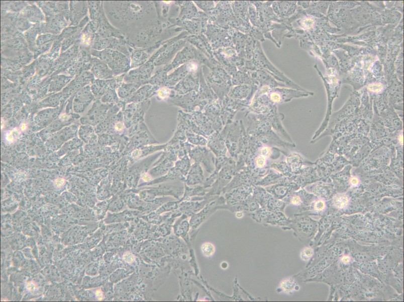 TTA1 Cell Complete Medium - 4