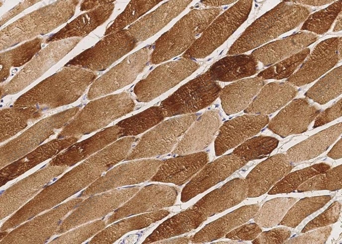 CKM Monoclonal Antibody - 1