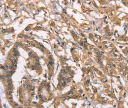 PEBP1 Polyclonal Antibody - 2