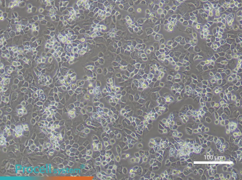Mouse Nucleus Pulposus cellsMouse Nucleus Pulposus cells - 3