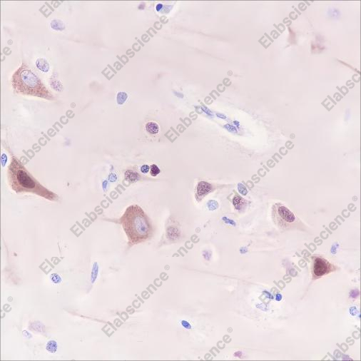 Recombinant Homer1 Monoclonal Antibody - 2