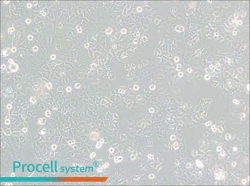 KYSE-150 Cell Complete Medium - 1