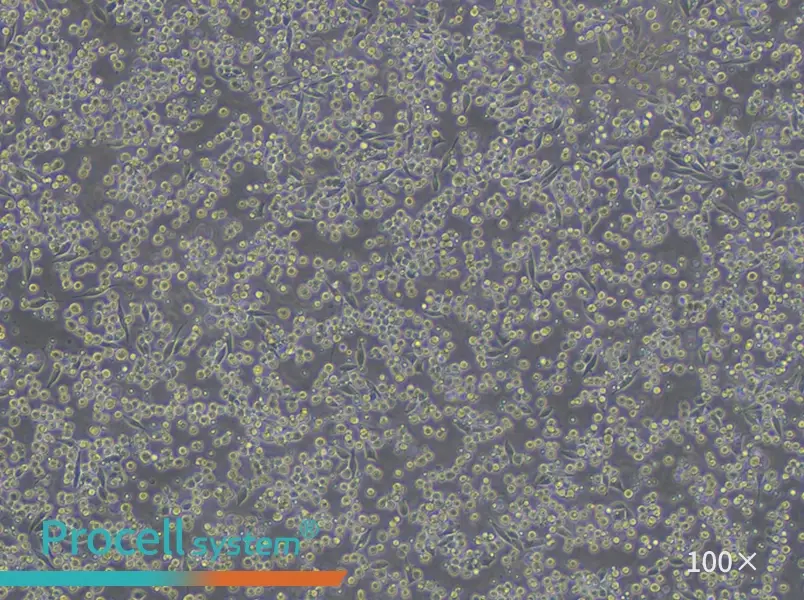 P815 Cell Complete Medium - 1