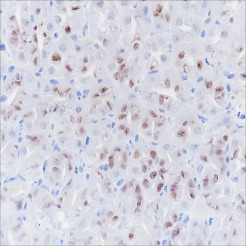 Recombinant SOX2 Monoclonal Antibody - small - 4