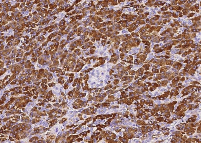 Carboxypeptidase A1/CPA1 Monoclonal Antibody - small - 1