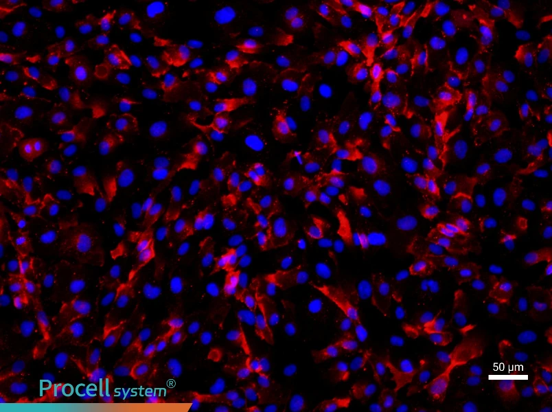 Human Umbilical Vein Endothelial Cell Complete Medium - 1