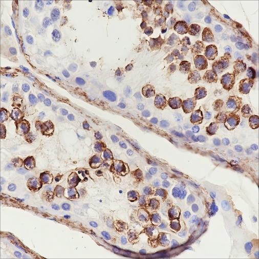 Recombinant Serum Amyloid P/SAP Monoclonal Antibody - small - 3