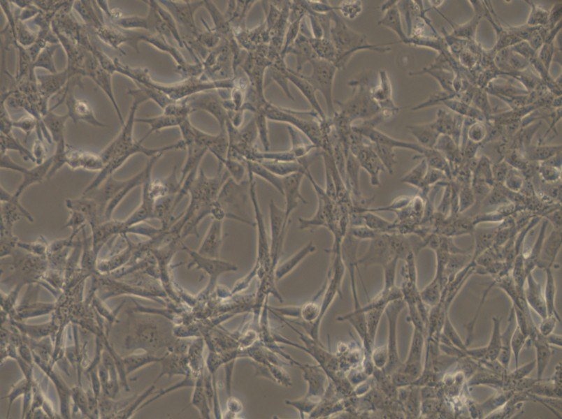 ES-2 Cell Complete Medium - 5