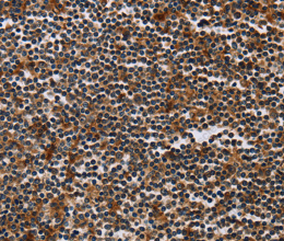 MAGEA3 Polyclonal Antibody - 2