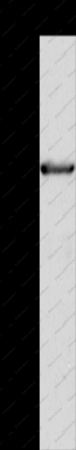 ALDH4A1 Polyclonal Antibody - 1