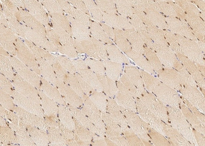 Recombinant BMI1 Monoclonal Antibody - small - 1