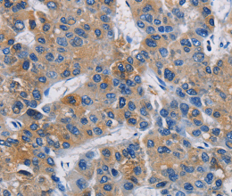 GPM6A Polyclonal Antibody - 3