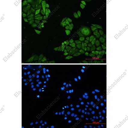 Recombinant Annexin 4 Monoclonal Antibody - 3