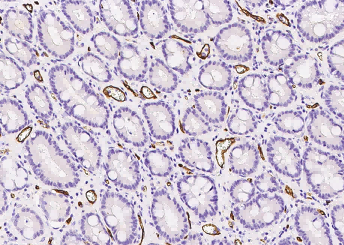 CD34 Monoclonal Antibody