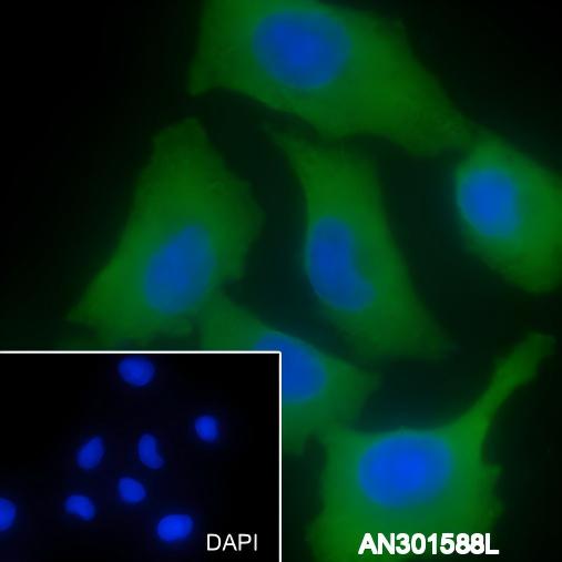 Recombinant LPCAT1 Monoclonal Antibody - 3