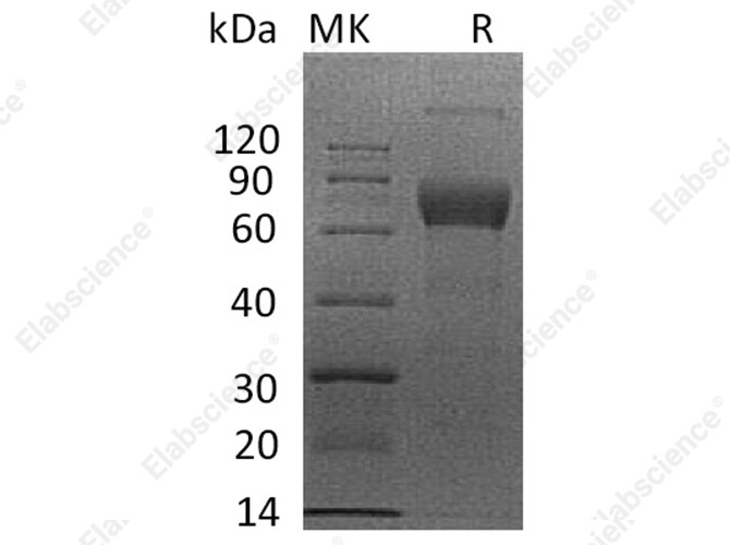 Recombinant Human IL4RA/CD124 Protein (mFc Tag) - 1