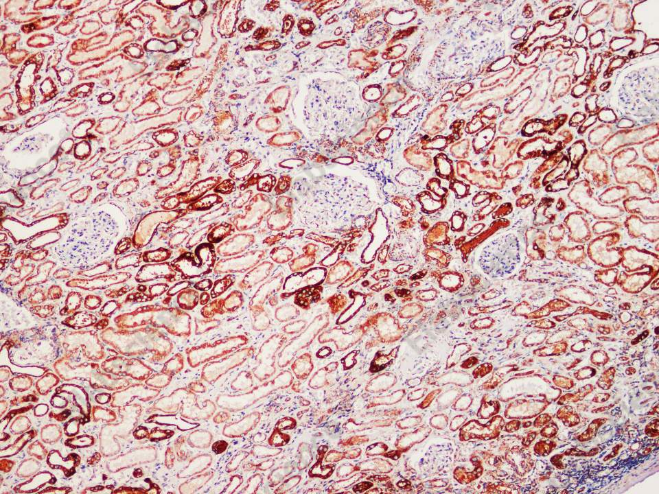 Recombinant SOD2 Monoclonal Antibody - 1