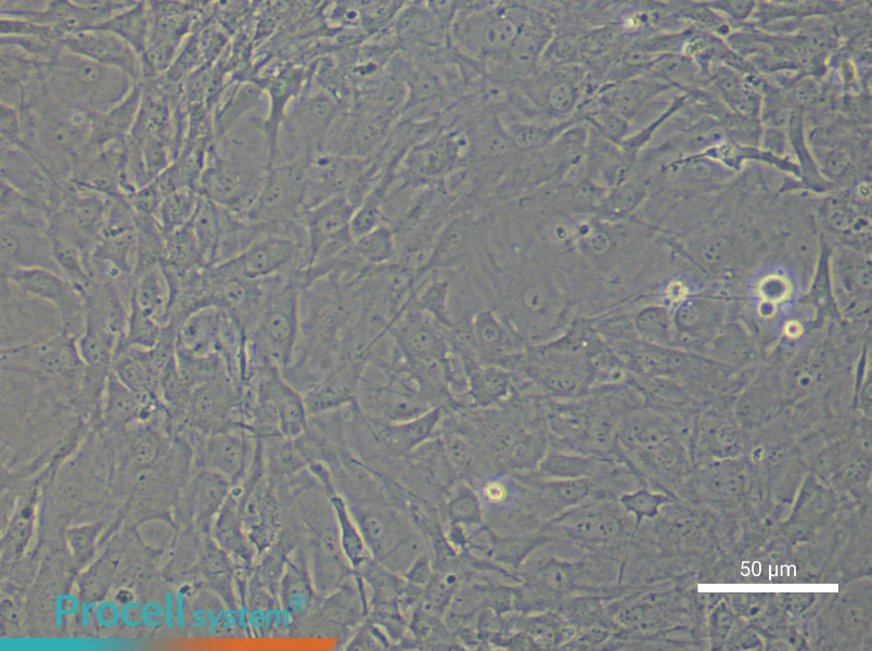 Mouse Scleral Fibroblasts - 6