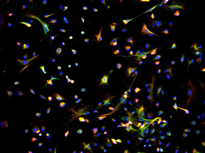 Mouse Peritoneal Mesothelial Cell Complete MediumMouse Peritoneal Mesothelial Cell Complete Medium - 2