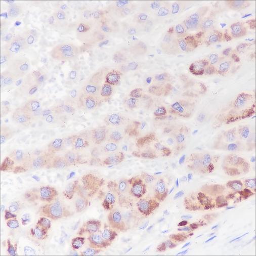Recombinant PDK1 Monoclonal Antibody - small - 3