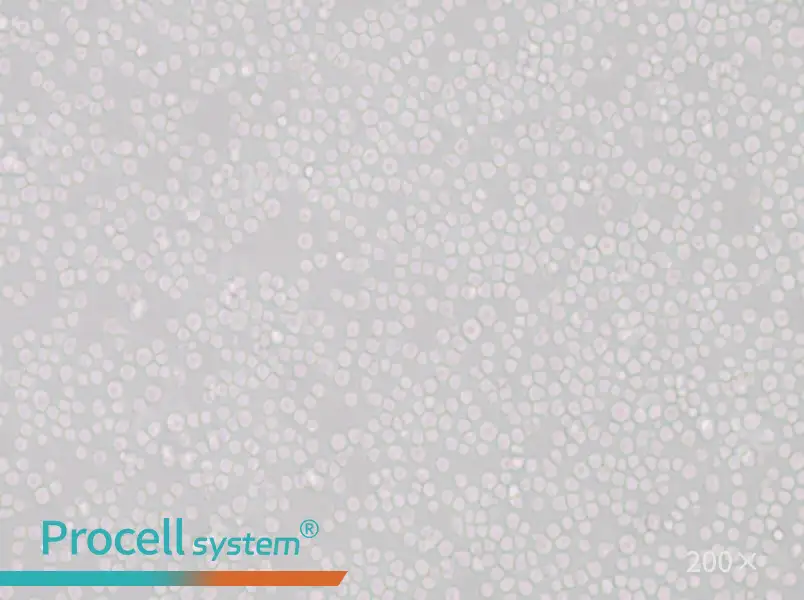 SU-DHL-8 Cell Complete Medium - 4